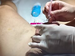 Brazilian Wax for a Chubby Quaggy Dick Part 4 Wax and Tweez